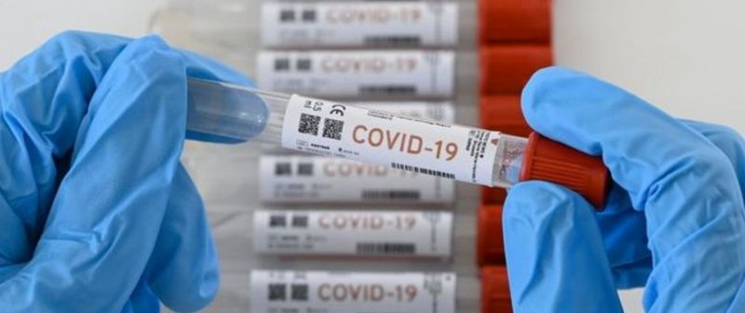 ADI, ANTAD y ANADIM acuerdan esquema para aplicación de pruebas Covid-19 gratis en CDMX