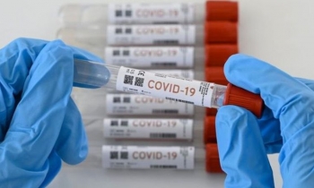 ADI, ANTAD y ANADIM acuerdan esquema para aplicación de pruebas Covid-19 gratis en CDMX